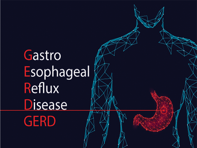 Treating GERD - A Spotlight on Alginate-Based Therapies