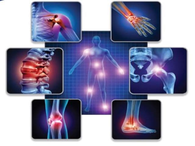 Current Trends in Rheumatoid Arthritis Management